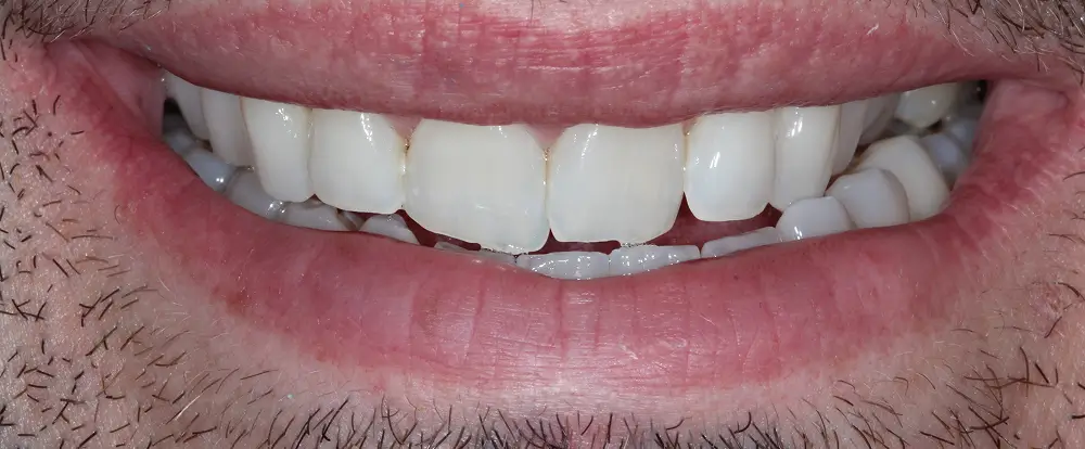 After-last After-last