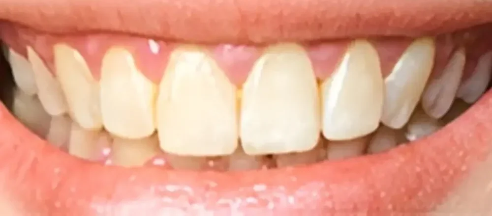 before-img-final before-img-final