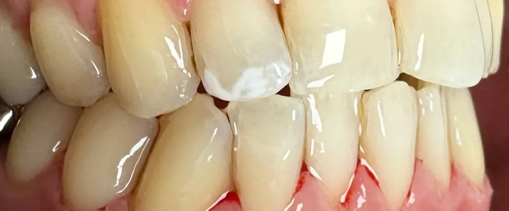 after-new-1 after-new-1