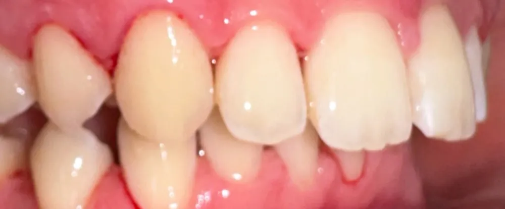 after-new-2 after-new-2