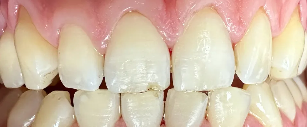 after-new-3 after-new-3