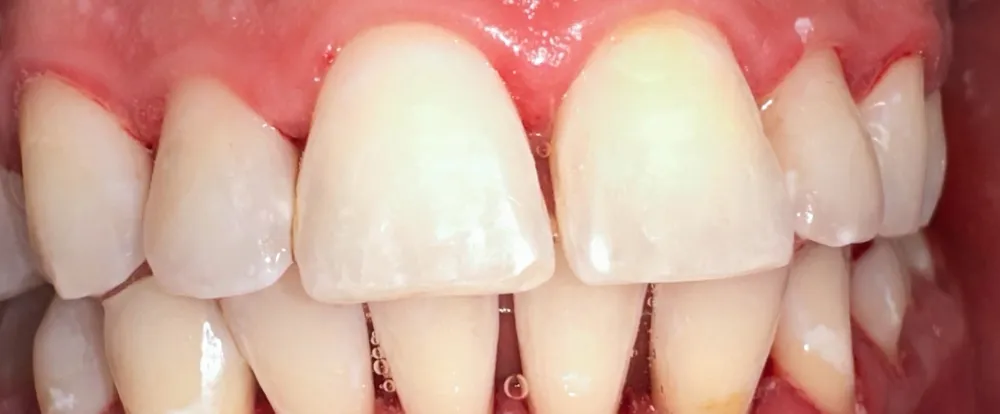 after-new-4 after-new-4