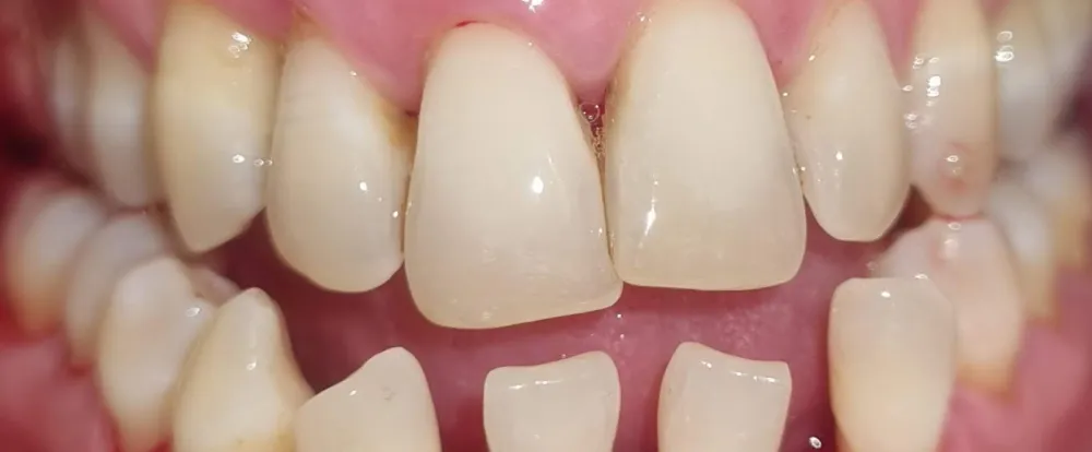 after-new-5 after-new-5