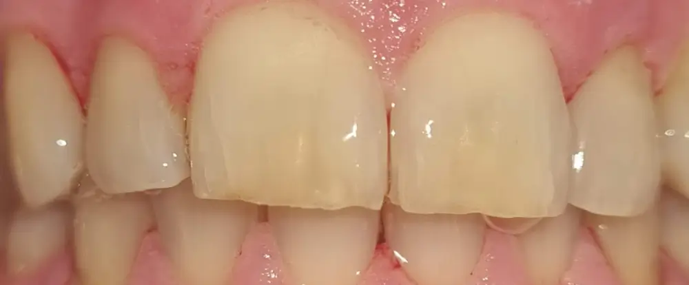 after-new-6 after-new-6