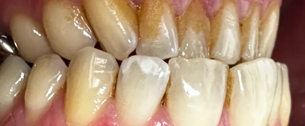 before-new-1 before-new-1