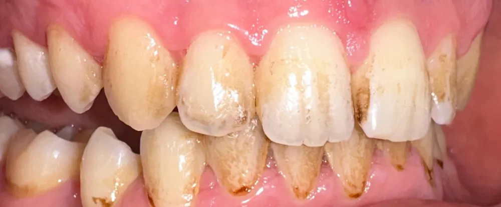 before-new-2 before-new-2