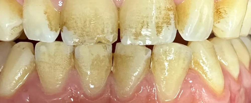 before-new-3 before-new-3