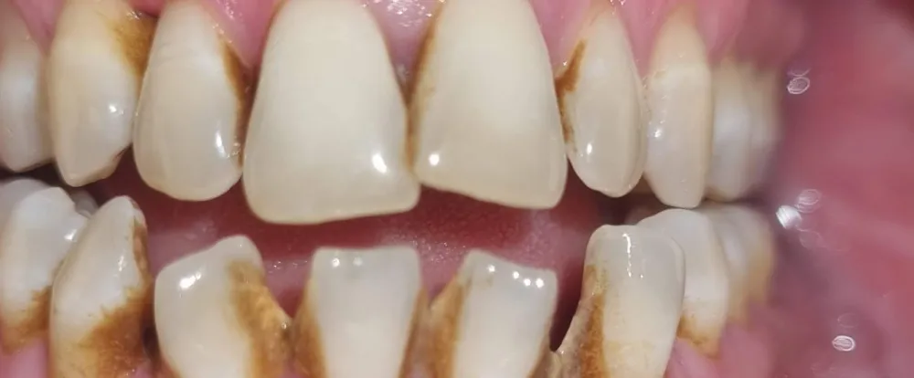 before-new-5 before-new-5