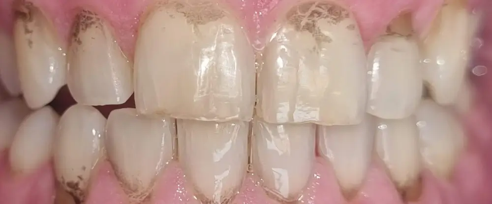 before-new-6 before-new-6