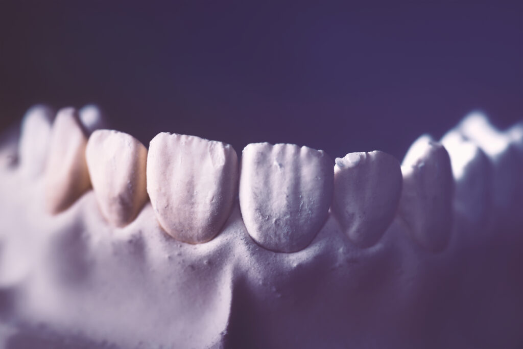 Genetic Curiosity Can You Be Born with Soft Teeth