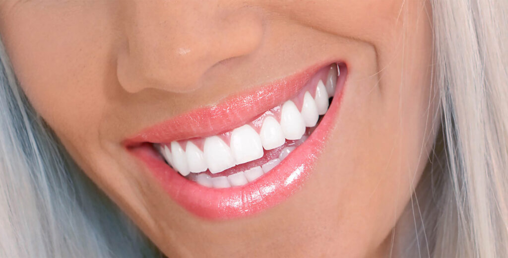 Can Anyone Get Teeth Whitening Who Is (and Isn’t) a Good Candidate