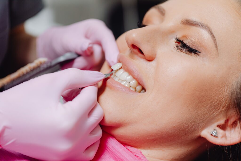 How Long Does Professional Whitening Really Last?